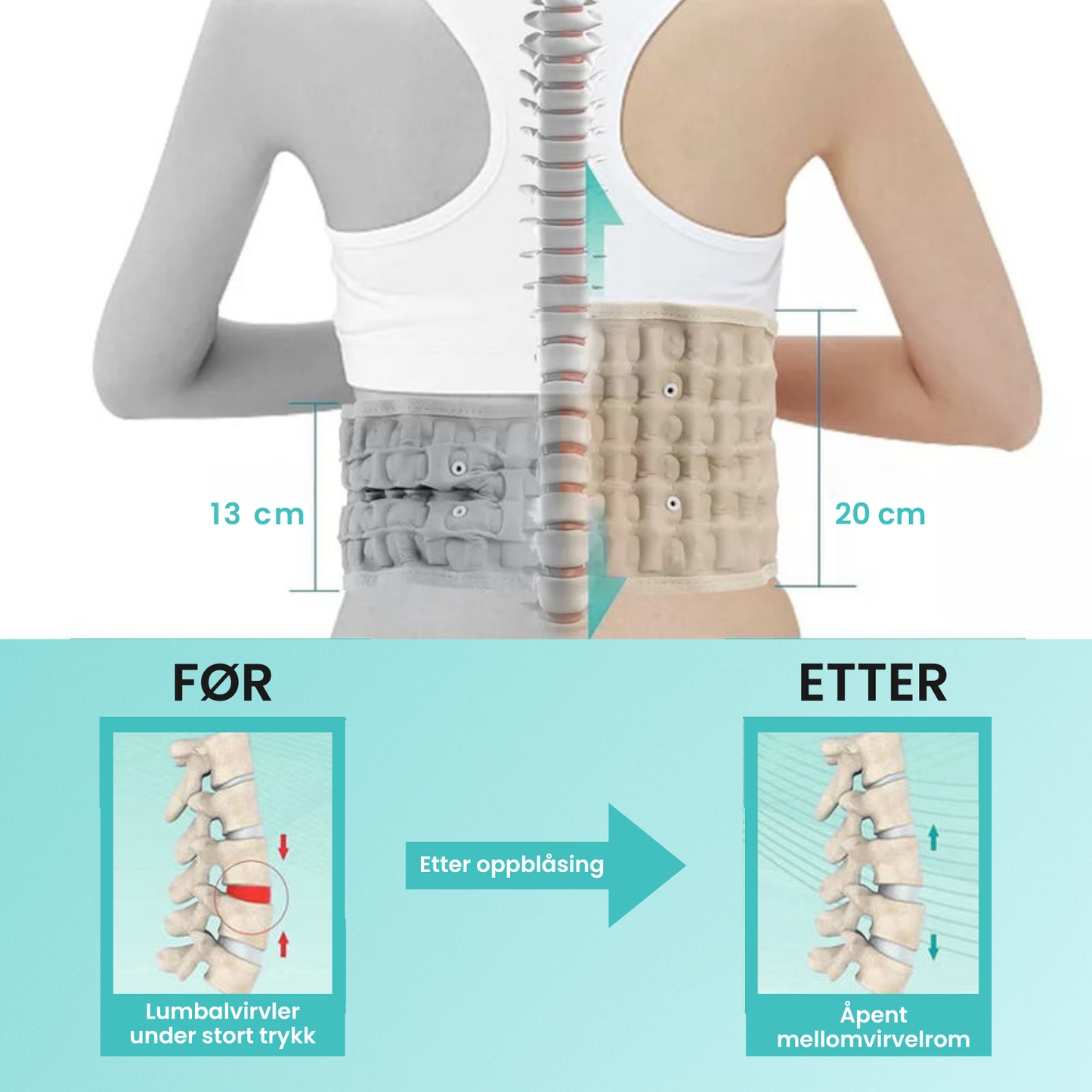 LumbarMax™ – Ortopedisk ryggbelte for korsryggstøtte